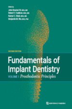 Fundamentals of Implant Dentistry, Volume 1: Prosthodontic Principles, Second edition
