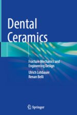 Dental Ceramics Fracture Mechanics and Engineering Design