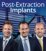 Post-Extraction Implants