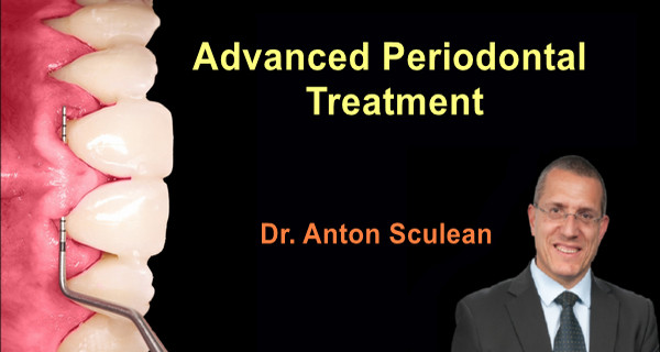 Advanced Periodontal Treatment Video Course Online Dental Library