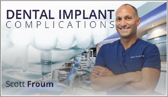 Dental Implant Complications (Video Course) - Online Dental Library