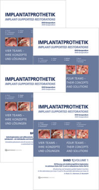 Implant-Supported Restorations – Vol. 1- 4 – (Video Course)