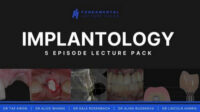 Implantology: 5 Episode Lecture Pack