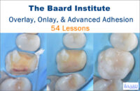 Overlay, Onlay, & Advanced Adhesion