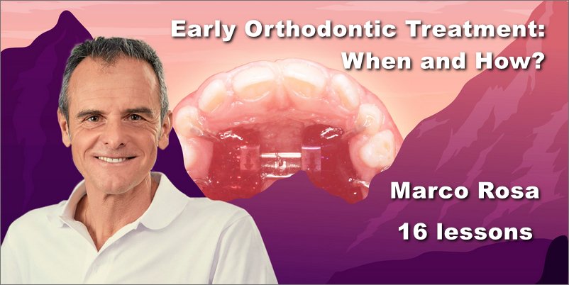 Early Orthodontic Treatment: When and How? - Online Dental Library