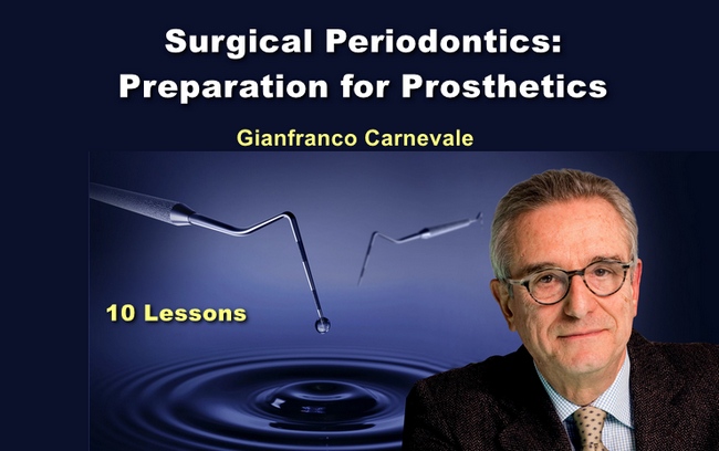 Surgical Periodontics Preparation For Prosthetics Online Dental Library