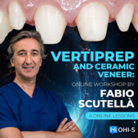 Vertical Preparation and Ceramic Veneers Vertical Preparation and Ceramic Veneers