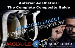 Anterior Aesthetics: The Complete Composite Guide