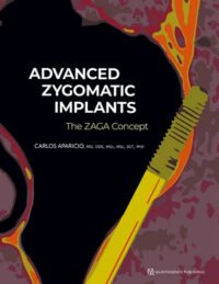 Advanced Zygomatic Implants: The ZAGA Concept