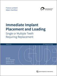 Immediate Implant Placement and Loading