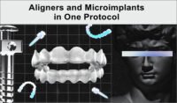 Aligners and Microimplants in One Protocol