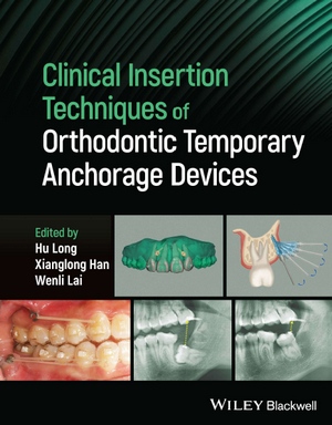 Clinical Insertion Techniques of Orthodontic Temporary Anchorage ...