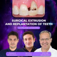 Surgical Extrusion and Replantation of Teeth