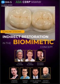 Indirect Restoration in the Biomimetic Concept