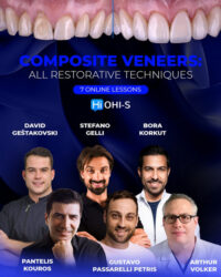 Composite Veneers: All Restorative Techniques