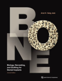 BONE: Biology, Harvesting, and Grafting for Dental Implants, 2nd Edition