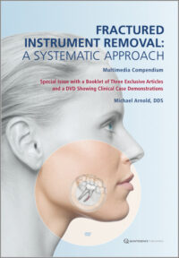 Fractured Instrument Removal: A Systematic Approach