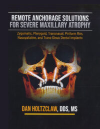 Remote Anchorage Solutions for Severe Maxillary Atrophy (Scanned Copy)