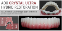 AOX Crystal Ultra Hybrid Restoration – ALL Clinical & Lab Steps Start to Finish