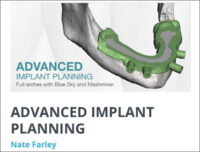 Advanced Implant Planning Course (Full Arch with Blue Sky and Meshmixer)