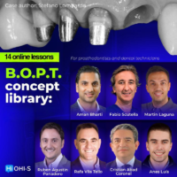 B.O.P.T. Concept Encyclopedia For Prosthodontists and Dental Technicians