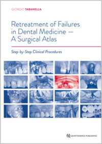 Retreatment of Failures in Dental Medicine – A Surgical Atlas (Scanned Copy)