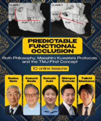 Predictable Functional Occlusion
