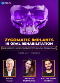 Zygomatic Implants in Oral Rehabilitation: For surgeons, prosthodontists, dental technicians