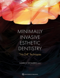 Minimally Invasive Esthetic Dentistry: “No Drill” Techniques