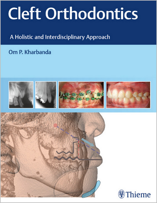 Cleft Orthodontics: A Holistic and Interdisciplinary Approach Cleft Orthodontics: A Holistic and Interdisciplinary Approach