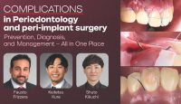 Complications in Periodontology and Peri-implant Surgery Prevention, Diagnosis, and Management – All in One Place Complications in Periodontology and Peri-implant Surgery Prevention, Diagnosis, and Management – All in One Place