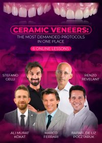 Ceramic Veneers: the Most Demanded Protocols in one Place