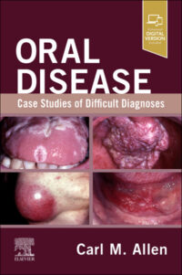 Oral Disease: Case Studies of Difficult Diagnoses